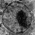 Elektronenmikroskopische Aufnahme des Zellkerns