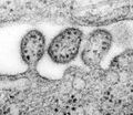 Lassa-Virus in der späten Phase der Abschnürung der Virushülle